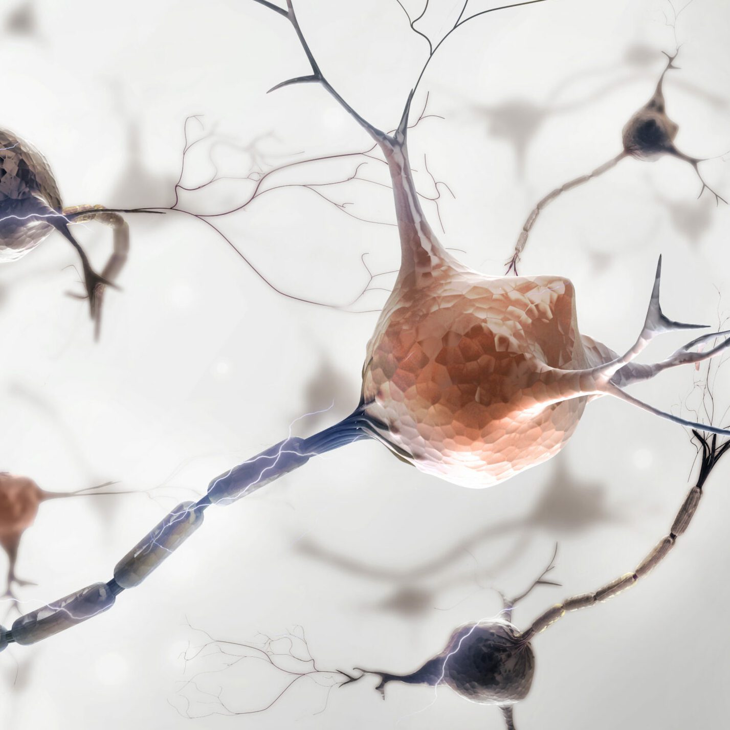 ALS and Other Motor Neuron Diseases: What’s the Difference?